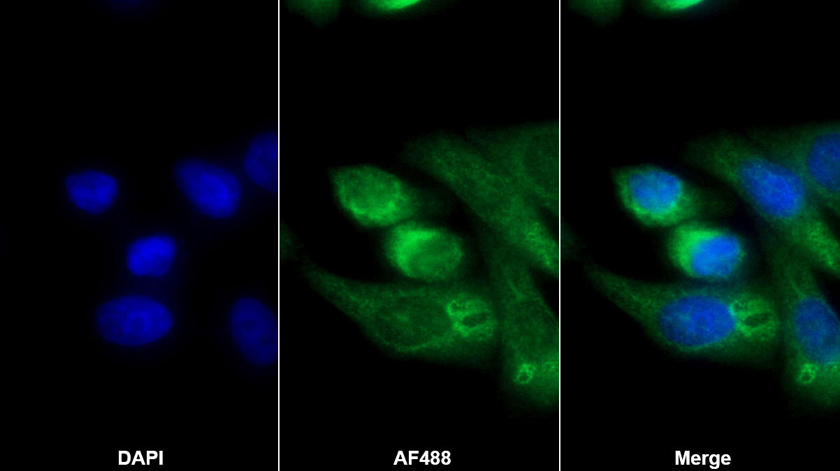 Polyclonal Antibody to Agrin (AGRN)