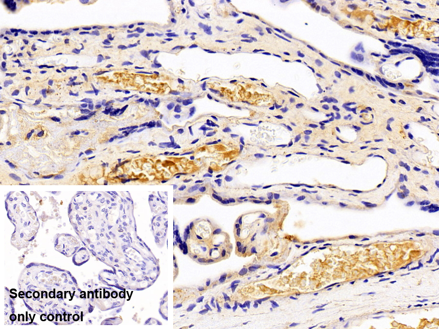 Polyclonal Antibody to Complement C4-B (C4B)