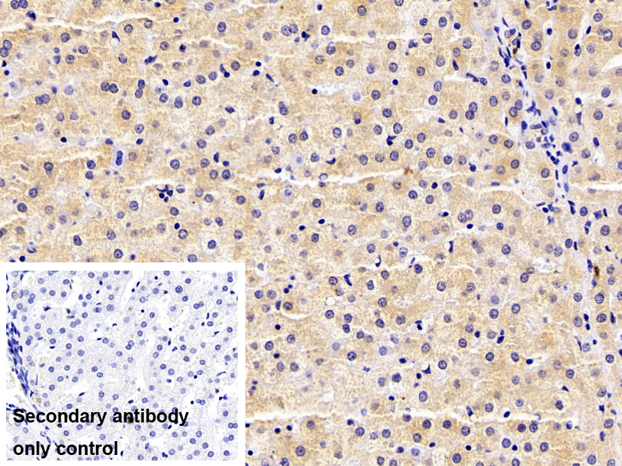 Polyclonal Antibody to Complement C4-B (C4B)