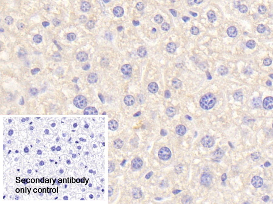 Polyclonal Antibody to Complement C4-B (C4B)