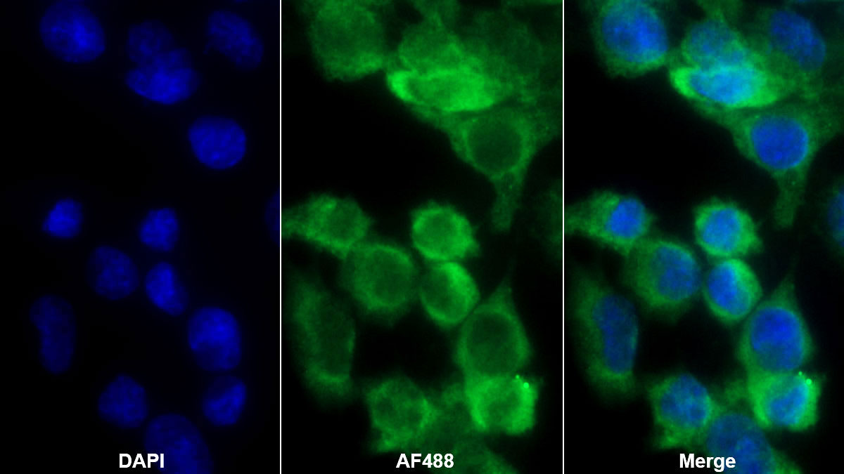 Polyclonal Antibody to Complement C4-B (C4B)