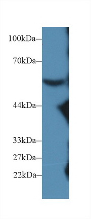 Polyclonal Antibody to Complement Component 8b (C8b)