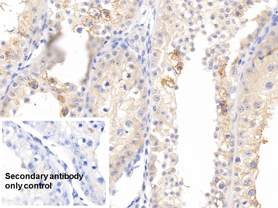 Polyclonal Antibody to Pleiotrophin (PTN)