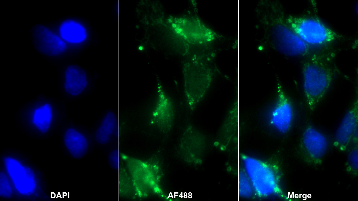 Polyclonal Antibody to Pleiotrophin (PTN)