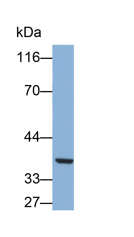 Polyclonal Antibody to Chymotrypsin C (CTRC)