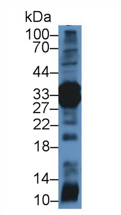 Polyclonal Antibody to Chymotrypsin C (CTRC)