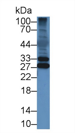 Polyclonal Antibody to Chymotrypsin C (CTRC)