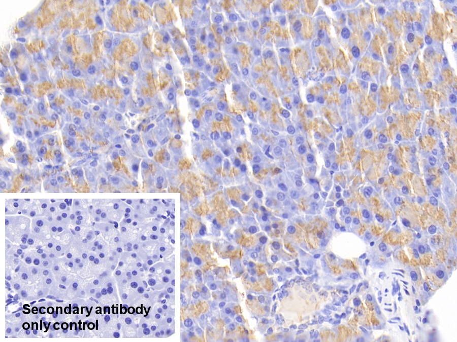 Polyclonal Antibody to Chymotrypsin C (CTRC)