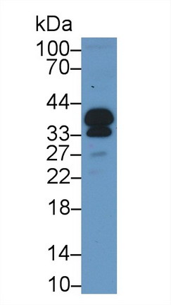 Polyclonal Antibody to Proopiomelanocortin (POMC)