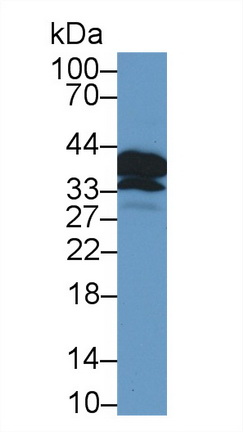 Polyclonal Antibody to Proopiomelanocortin (POMC)