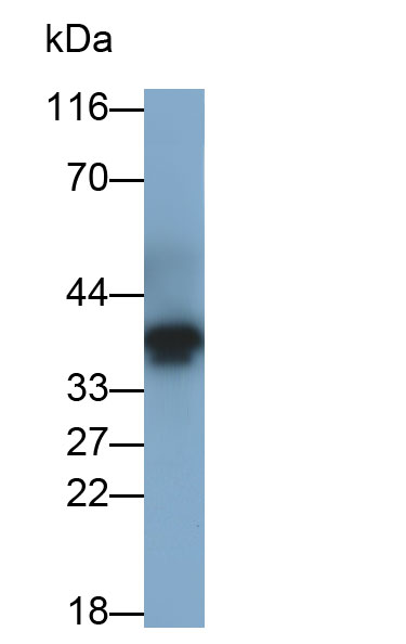 Polyclonal Antibody to Proopiomelanocortin (POMC)