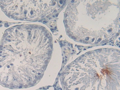 Polyclonal Antibody to Proopiomelanocortin (POMC)