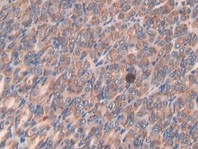 Polyclonal Antibody to Secretory Leukocyte Peptidase Inhibitor (SLPI)