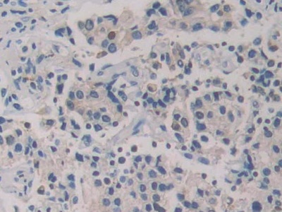 Polyclonal Antibody to Glutathione Reductase (GR)