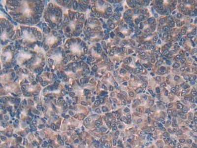 Polyclonal Antibody to Glutathione Reductase (GR)