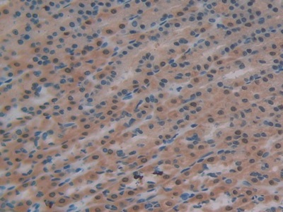 Polyclonal Antibody to Glutathione Reductase (GR)