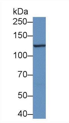 Polyclonal Antibody to Protein Tyrosine Kinase 2 Beta (PYK2)