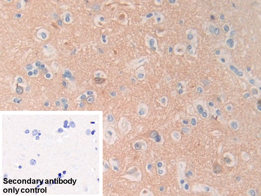 Polyclonal Antibody to Calcineurin (CaN)