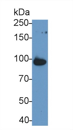 Polyclonal Antibody to Caldesmon (CALD)