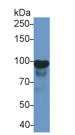 Polyclonal Antibody to Caldesmon (CALD)