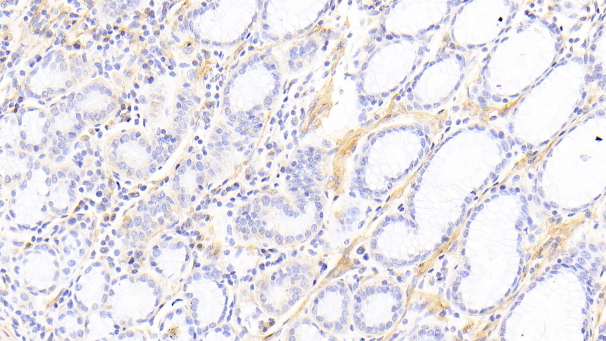 Polyclonal Antibody to Caldesmon (CALD)