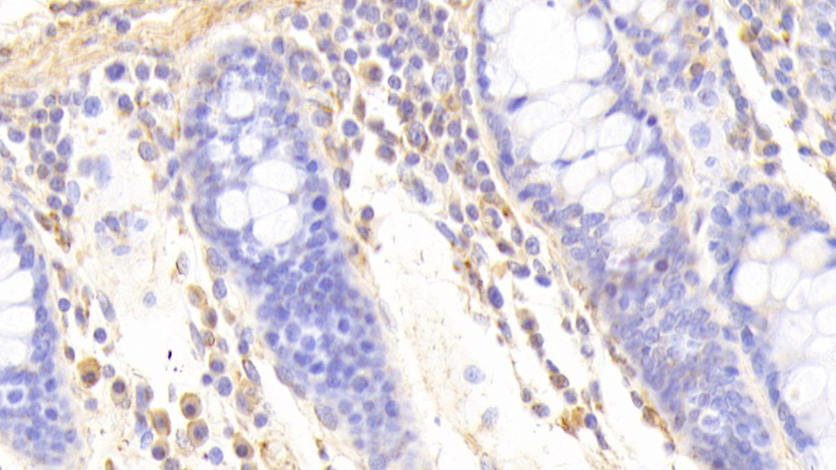 Polyclonal Antibody to Caldesmon (CALD)