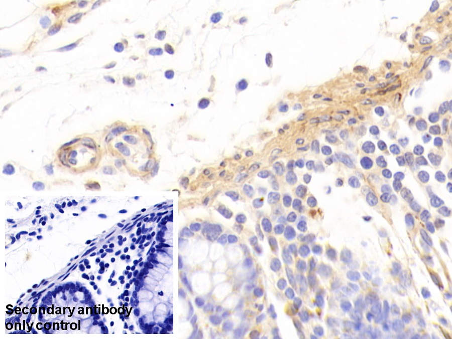 Polyclonal Antibody to Caldesmon (CALD)