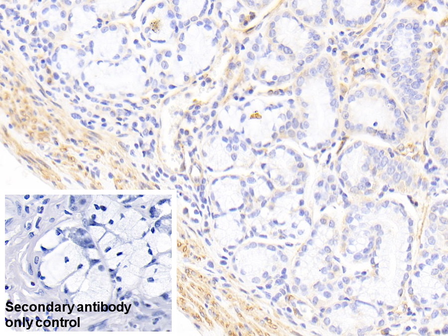 Polyclonal Antibody to Caldesmon (CALD)