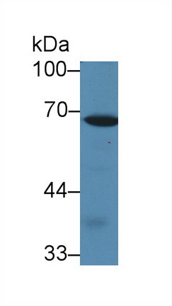 Polyclonal Antibody to Caldesmon (CALD)