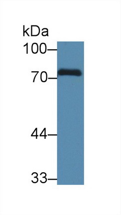 Polyclonal Antibody to Caldesmon (CALD)