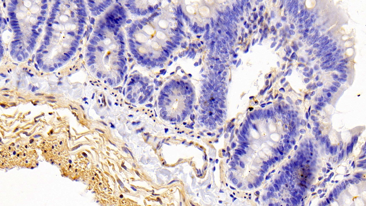 Polyclonal Antibody to Caldesmon (CALD)