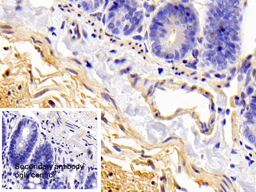 Polyclonal Antibody to Caldesmon (CALD)