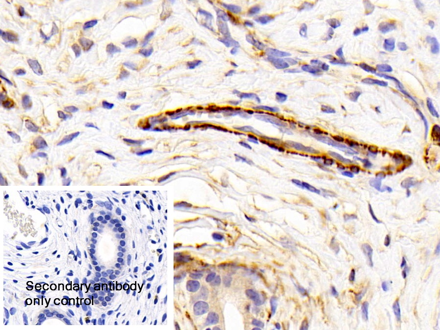 Polyclonal Antibody to Caldesmon (CALD)