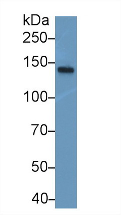 Polyclonal Antibody to Neurofilament 3 (NEF3)