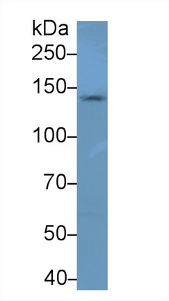 Polyclonal Antibody to Neurofilament 3 (NEF3)