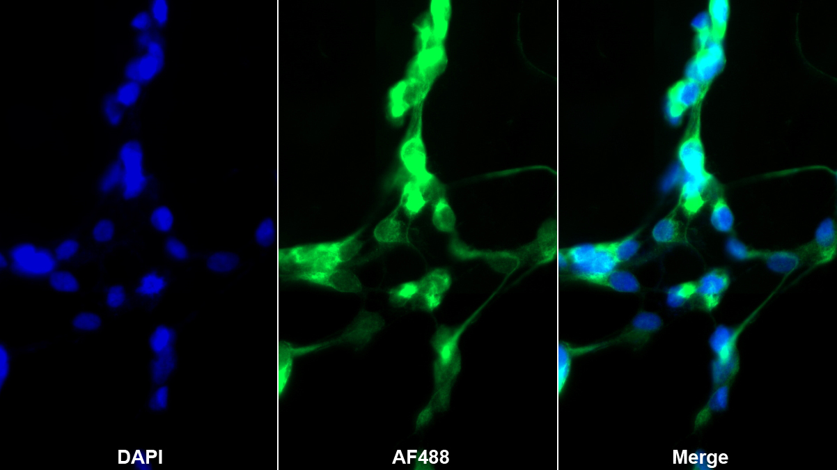 Polyclonal Antibody to Neurofilament 3 (NEF3)