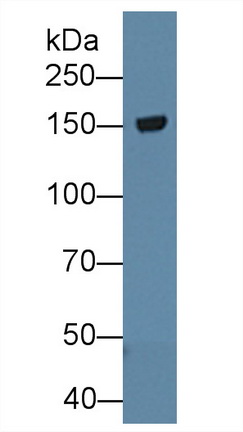 Polyclonal Antibody to Tenascin R (TNR)