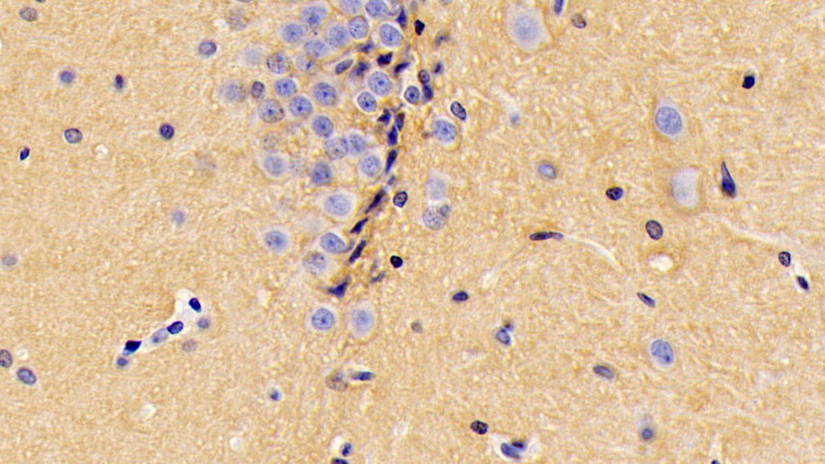 Polyclonal Antibody to Tenascin R (TNR)