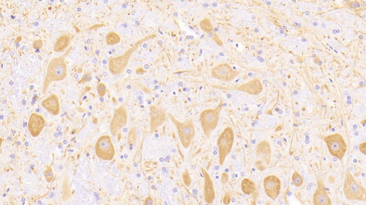 Polyclonal Antibody to Microtubule Associated Protein 2 (MAP2)