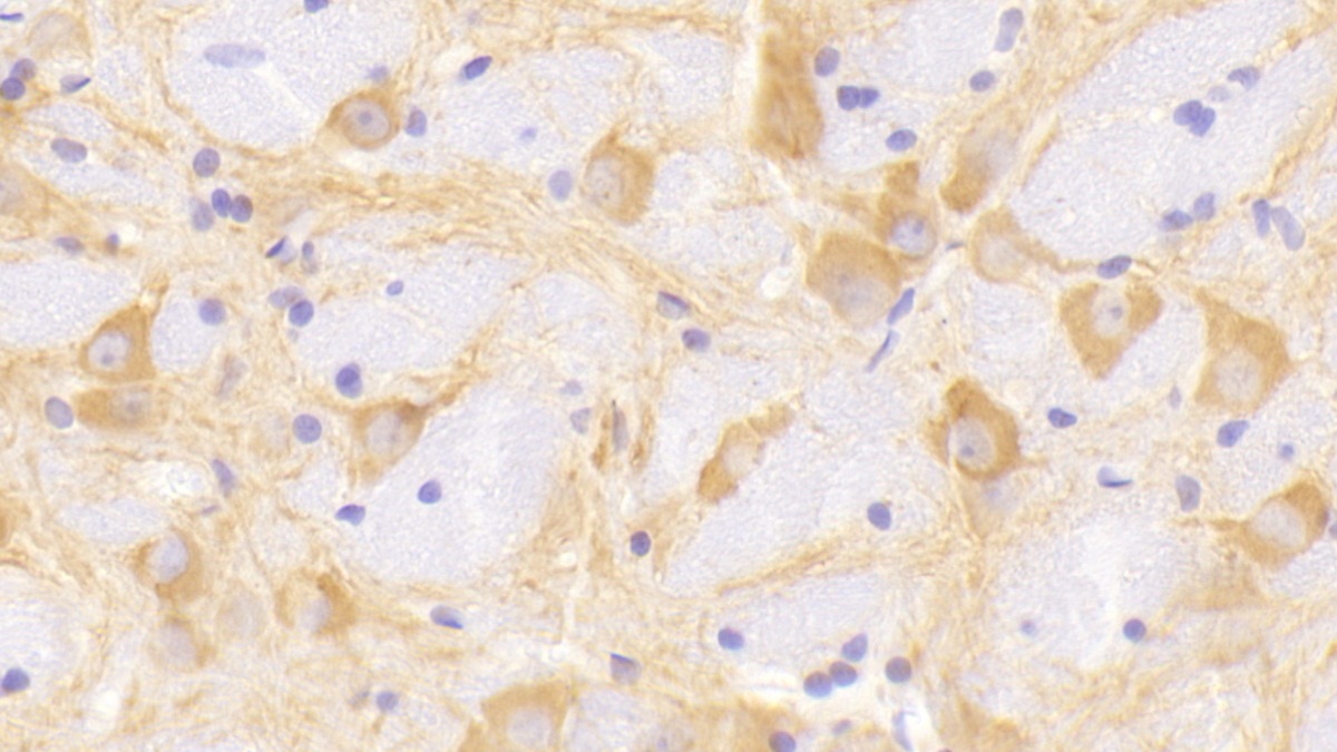 Polyclonal Antibody to Microtubule Associated Protein 2 (MAP2)