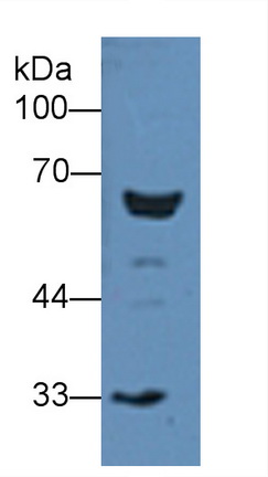 Polyclonal Antibody to Involucrin (INV)