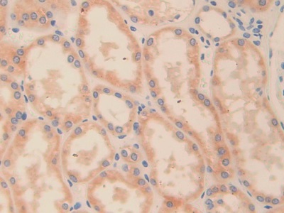 Polyclonal Antibody to Ornithine Decarboxylase (ODC)