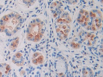 Polyclonal Antibody to Ornithine Decarboxylase (ODC)