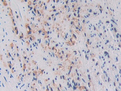 Polyclonal Antibody to Ornithine Decarboxylase (ODC)