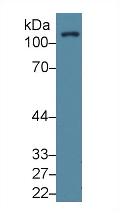 Polyclonal Antibody to Focal Adhesion Kinase (FAK)