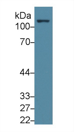 Polyclonal Antibody to Focal Adhesion Kinase (FAK)