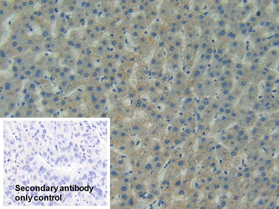 Polyclonal Antibody to Focal Adhesion Kinase (FAK)