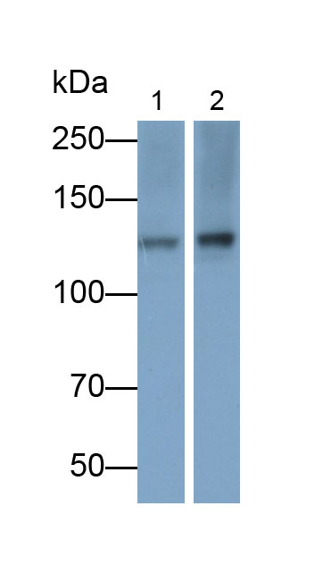 Polyclonal Antibody to Focal Adhesion Kinase (FAK)