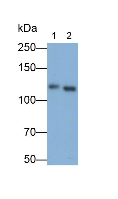 Polyclonal Antibody to Focal Adhesion Kinase (FAK)