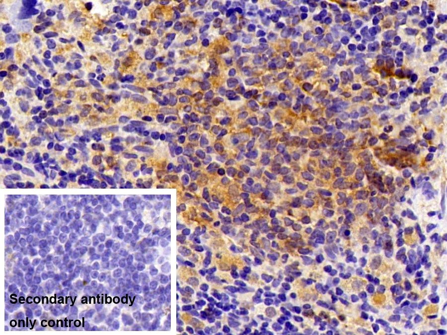 Polyclonal Antibody to Focal Adhesion Kinase (FAK)